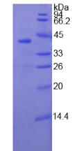 Recombinant Troponin T Type 1, Slow Skeletal (TNNT1)