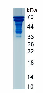 Recombinant Troponin T Type 2, Cardiac (TNNT2)