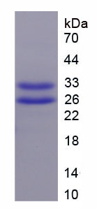 Recombinant Troponin T Type 2, Cardiac (TNNT2)