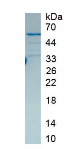 Recombinant Troponin T Type 2, Cardiac (TNNT2)