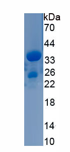 Recombinant Leukotriene A4 Hydrolase (LTA4H)