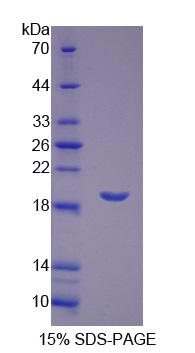 Recombinant Leukotriene A4 Hydrolase (LTA4H)