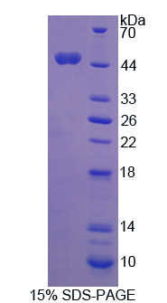 Recombinant Cyclin Dependent Kinase 8 (CDK8)