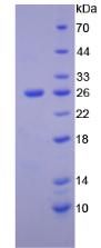 Recombinant Tyrosine Protein Kinase 7 (PTK7)