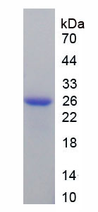 Recombinant Ferritin, Mitochondrial (FTMT)