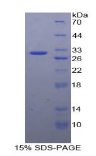 Recombinant G Protein Coupled Receptor Kinase 5 (GRK5)