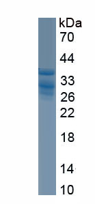 Recombinant Cytochrome C Oxidase Subunit IV Isoform 1 (COX4I1)