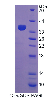 Recombinant Holocytochrome C Synthase (HCCS)