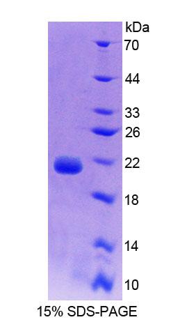 Recombinant Calmodulin 1 (CALM1)