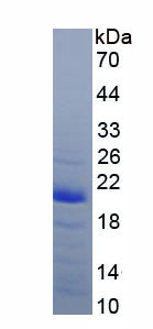 Recombinant Calmodulin 1 (CALM1)