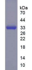 Recombinant Glycogen Synthase Kinase 3 Beta (GSK3b)