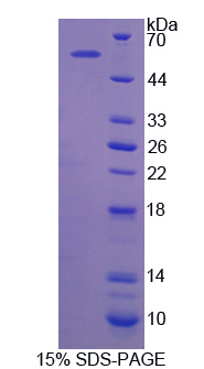 Recombinant Calcium/Calmodulin Dependent Protein Kinase II Alpha (CAMK2a)