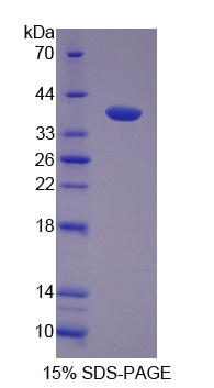 Recombinant Calcium/Calmodulin Dependent Protein Kinase II Beta (CAMK2b)