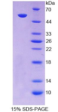 Recombinant Amiloride Sensitive Sodium Channel Subunit Alpha (SCNN1a)