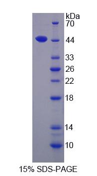 Recombinant Interleukin 17D (IL17D)