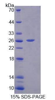 Recombinant Interleukin 17D (IL17D)