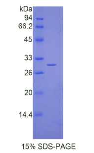 Recombinant Interleukin 17 Receptor D (IL17RD)