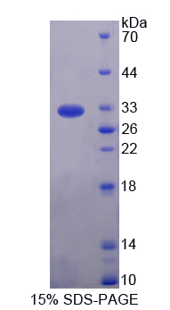 Recombinant Interleukin 17 Receptor D (IL17RD)