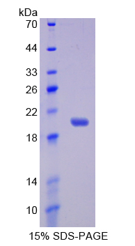 RPD351Hu01.jpg