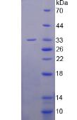 Recombinant Slit Homolog 3 (Slit3)