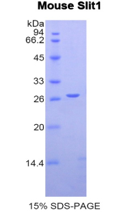 Recombinant Slit Homolog 1 (Slit1)