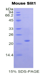 Recombinant Slit Homolog 1 (Slit1)