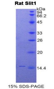 Recombinant Slit Homolog 1 (Slit1)