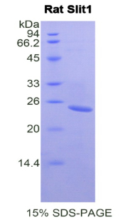 Recombinant Slit Homolog 1 (Slit1)