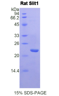 Recombinant Slit Homolog 1 (Slit1)