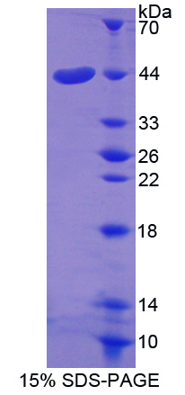 Recombinant Glia Derived Nexin (GDN)