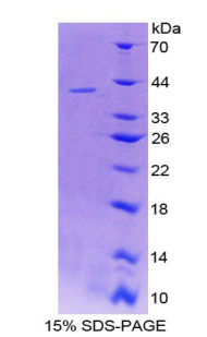 Recombinant Leukocyte Elastase Inhibitor (LEI)