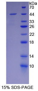 Recombinant Cytoplasmic Antiproteinase 3 (CAP3)