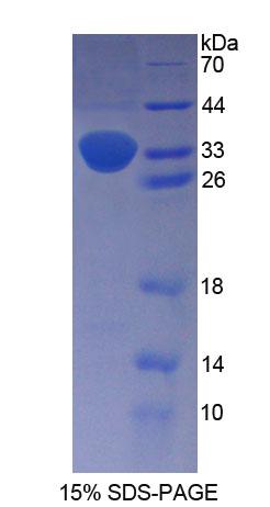 Recombinant Proenkephalin (PENK)