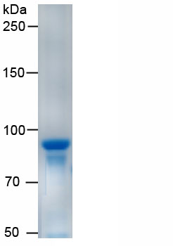 Recombinant Phosphofructokinase, Muscle (PFKM)