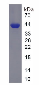 Recombinant Phosphofructokinase, Liver (PFKL)