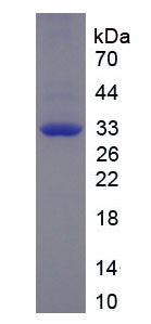 Recombinant Myosin Heavy Chain 3, Skeletal Muscle, Embryonic (MYH3)