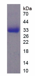 Recombinant Myosin Heavy Chain 4, Skeletal Muscle (MYH4)