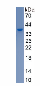 Recombinant Myosin Heavy Chain 6, Cardiac Muscle, Alpha (MYH6)