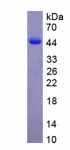 Recombinant Myosin Heavy Chain 11, Smooth Muscle (MYH11)