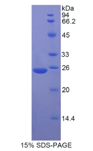 Recombinant Myosin Heavy Chain 8, Skeletal Muscle, Perinatal (MYH8)