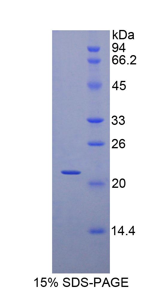 Recombinant Myosin Light Chain 3, Alkali, Ventricular, Slow Skeletal (MYL3)