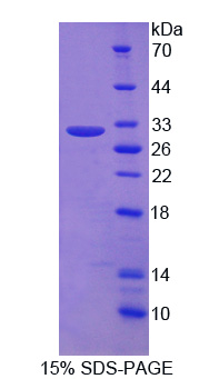 Recombinant Myosin Light Chain 6B, Alkali, Smooth Muscle And Non Muscle (MYL6B)
