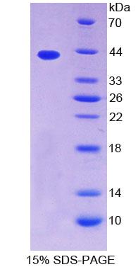 Recombinant Tropomyosin 2 Beta (TPM2)