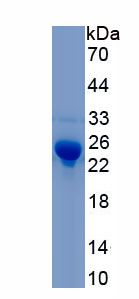 Recombinant Myosin Light Chain 9, Regulatory (MYL9)