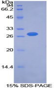 Recombinant Pyruvate Dehydrogenase Kinase Isozyme 2 (PDK2)