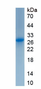 Recombinant Protease, Serine 3 (PRSS3)
