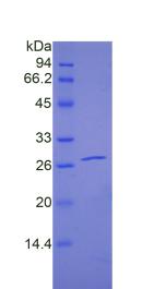 Recombinant Pappalysin 2 (PAPPA2)