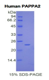 Recombinant Pappalysin 2 (PAPPA2)