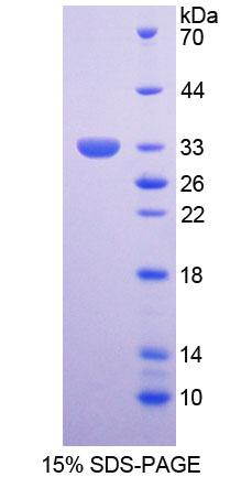 Recombinant Survival Of Motor Neuron 2, Centromeric (SMN2)