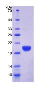 Recombinant Apolipoprotein L2 (APOL2)